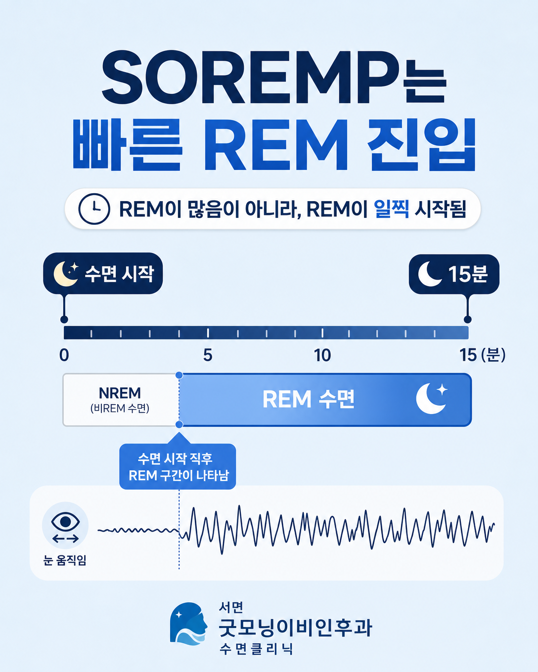 수면 시작 후 15분 이내 렘수면이 나타나는 SOREMP의 시간적 의미