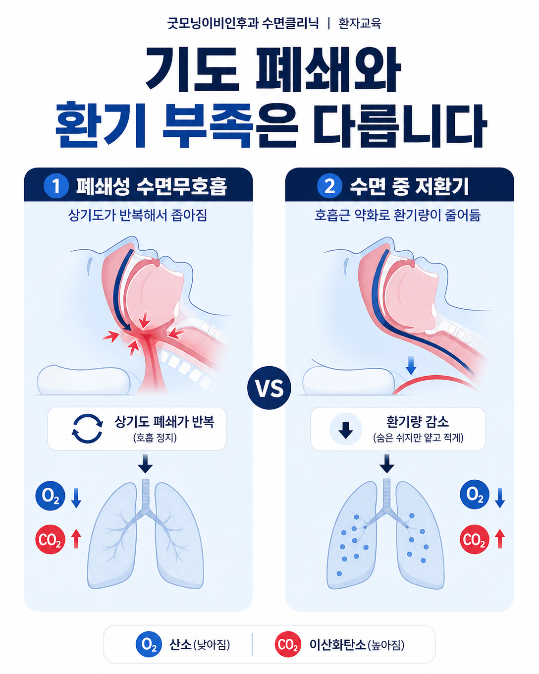 폐쇄성 수면무호흡과 수면 중 저환기의 기전 차이