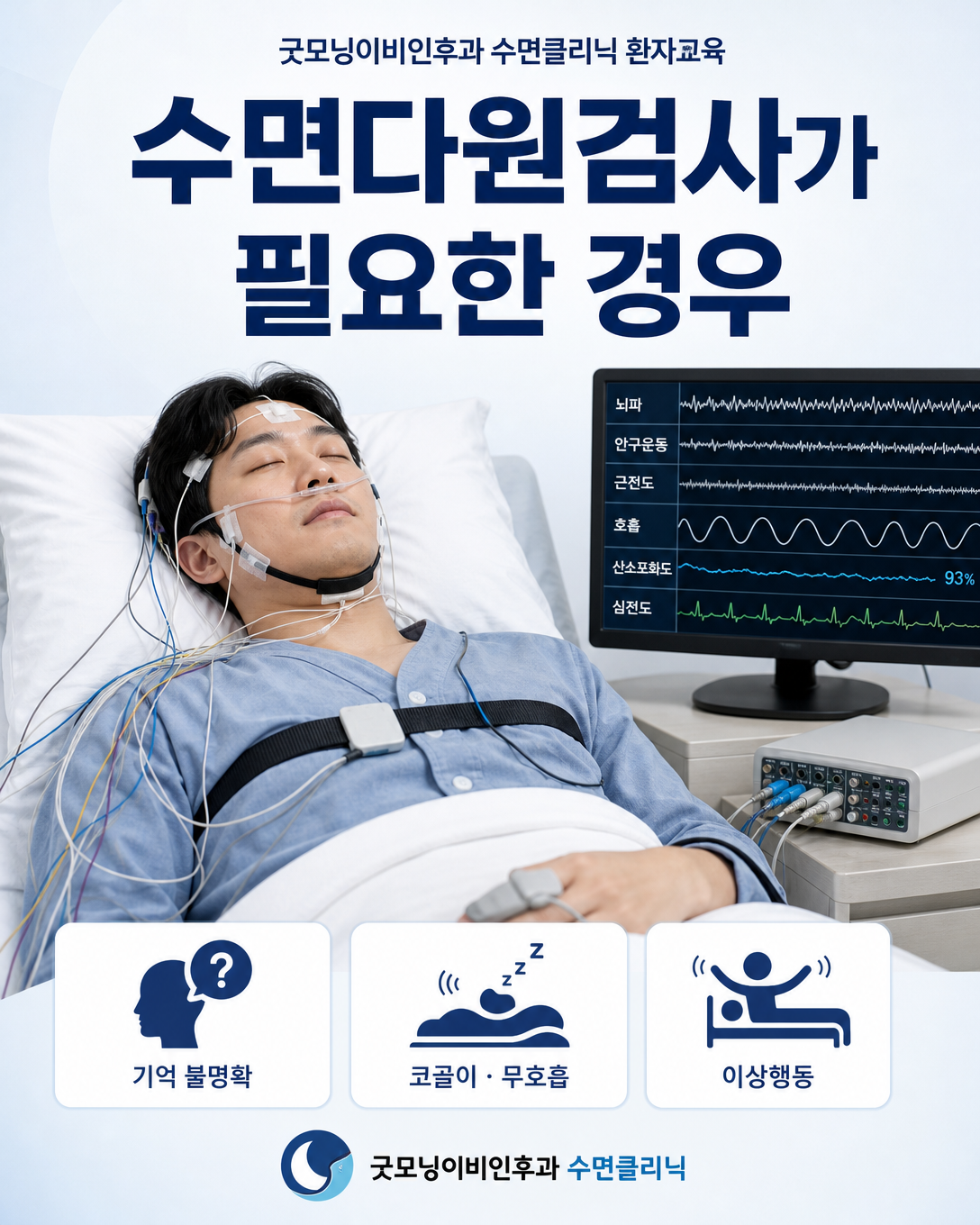 이상행동이나 코골이 등 동반 증상이 있을 때 수면다원검사를 고려하는 상황