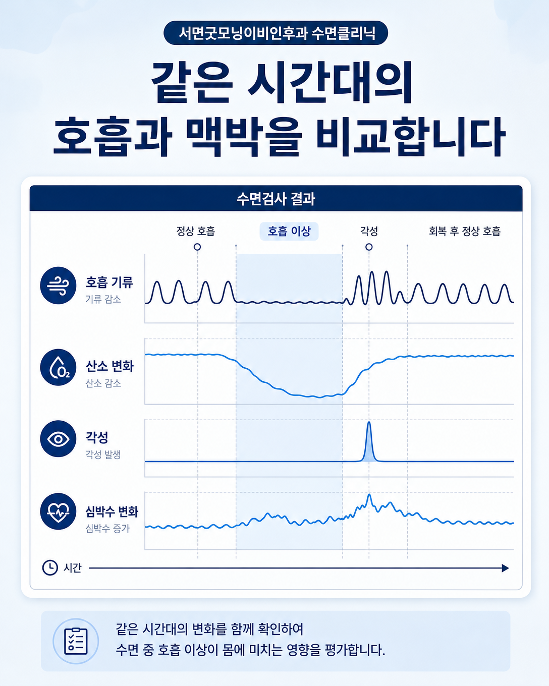 수면 중 호흡 변화와 산소포화도, 각성 및 심박수 기록을 같은 시간대에서 비교하는 이미지