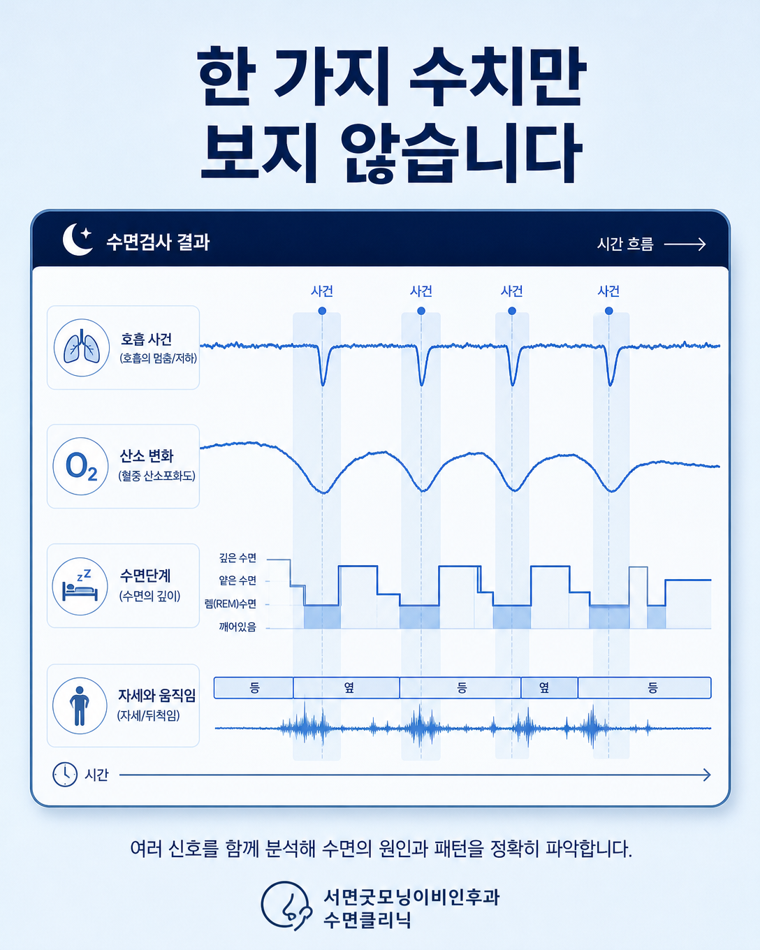 수면다원검사 결과에서 호흡, 산소, 수면단계와 자세를 함께 해석하는 화면