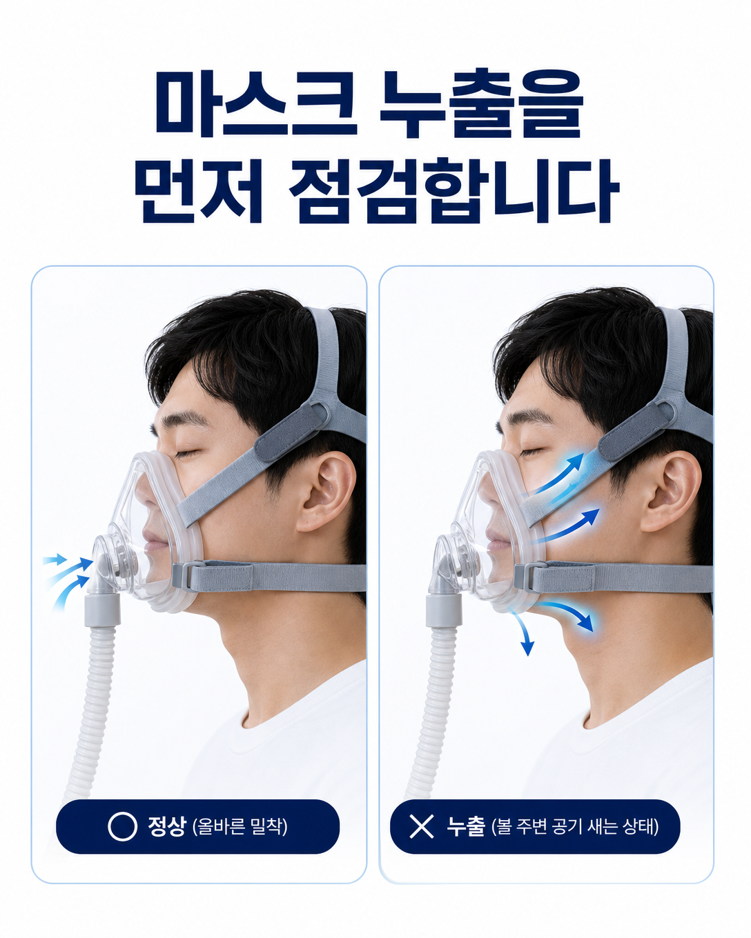 양압기 마스크의 정상 밀착 상태와 비의도적 공기 누출을 비교한 이미지
