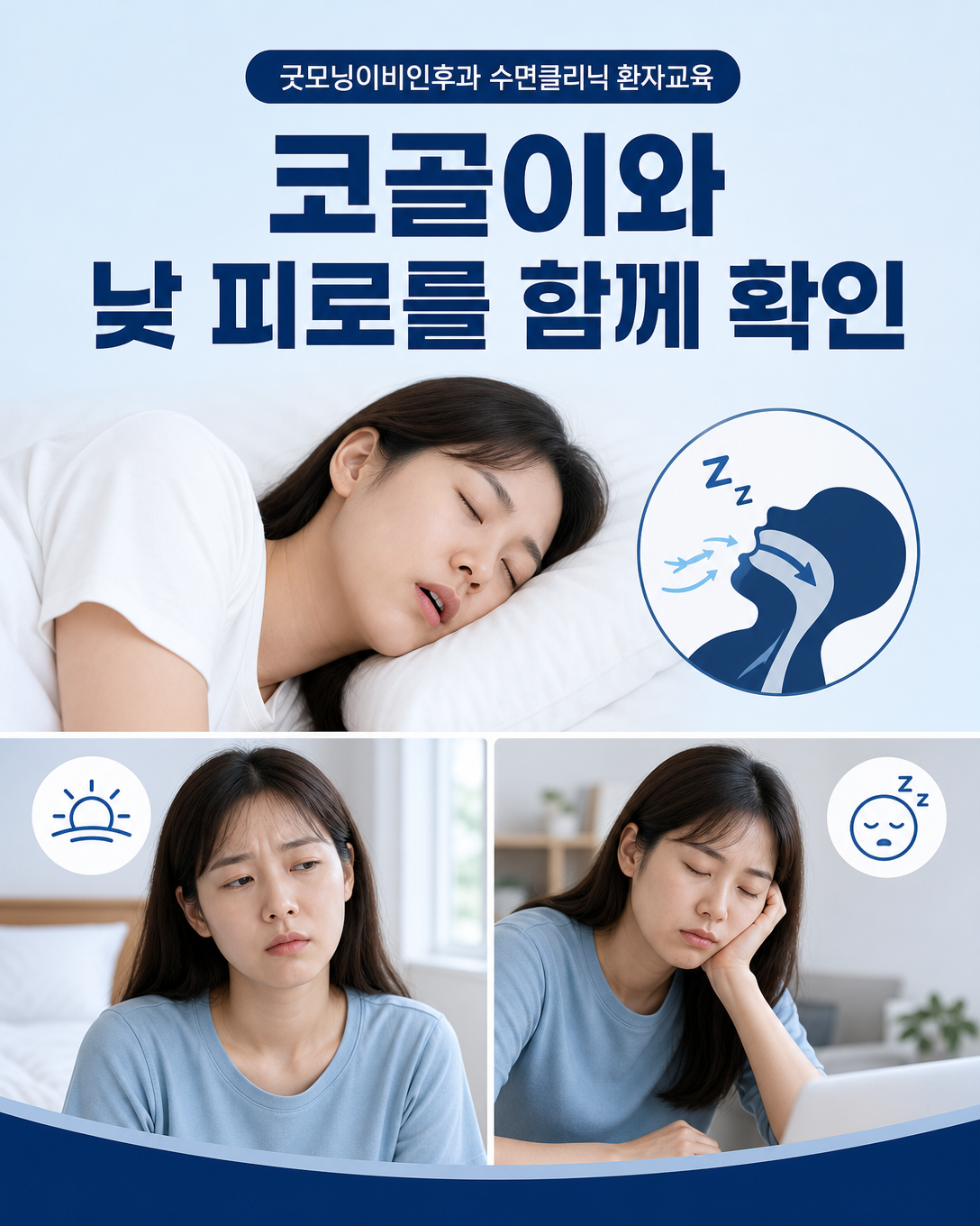 코골이와 개운하지 않은 잠, 낮 피로 등 수면무호흡증 의심 증상