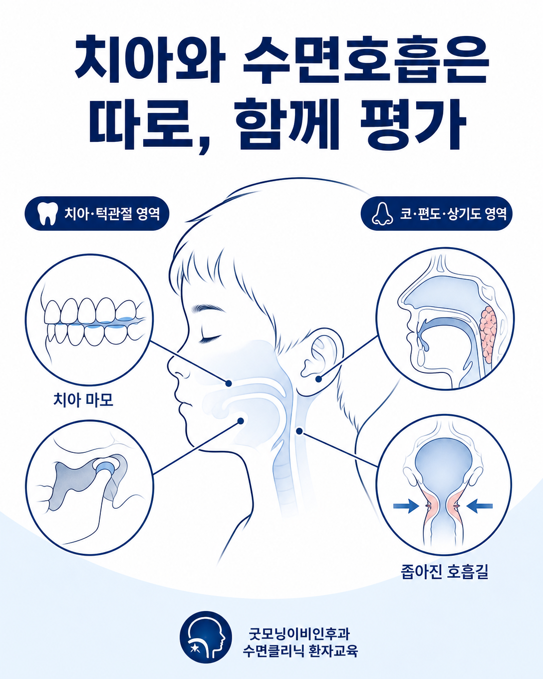 아이의 치아와 턱 상태 및 코와 편도, 상기도를 구분해 평가하는 도식