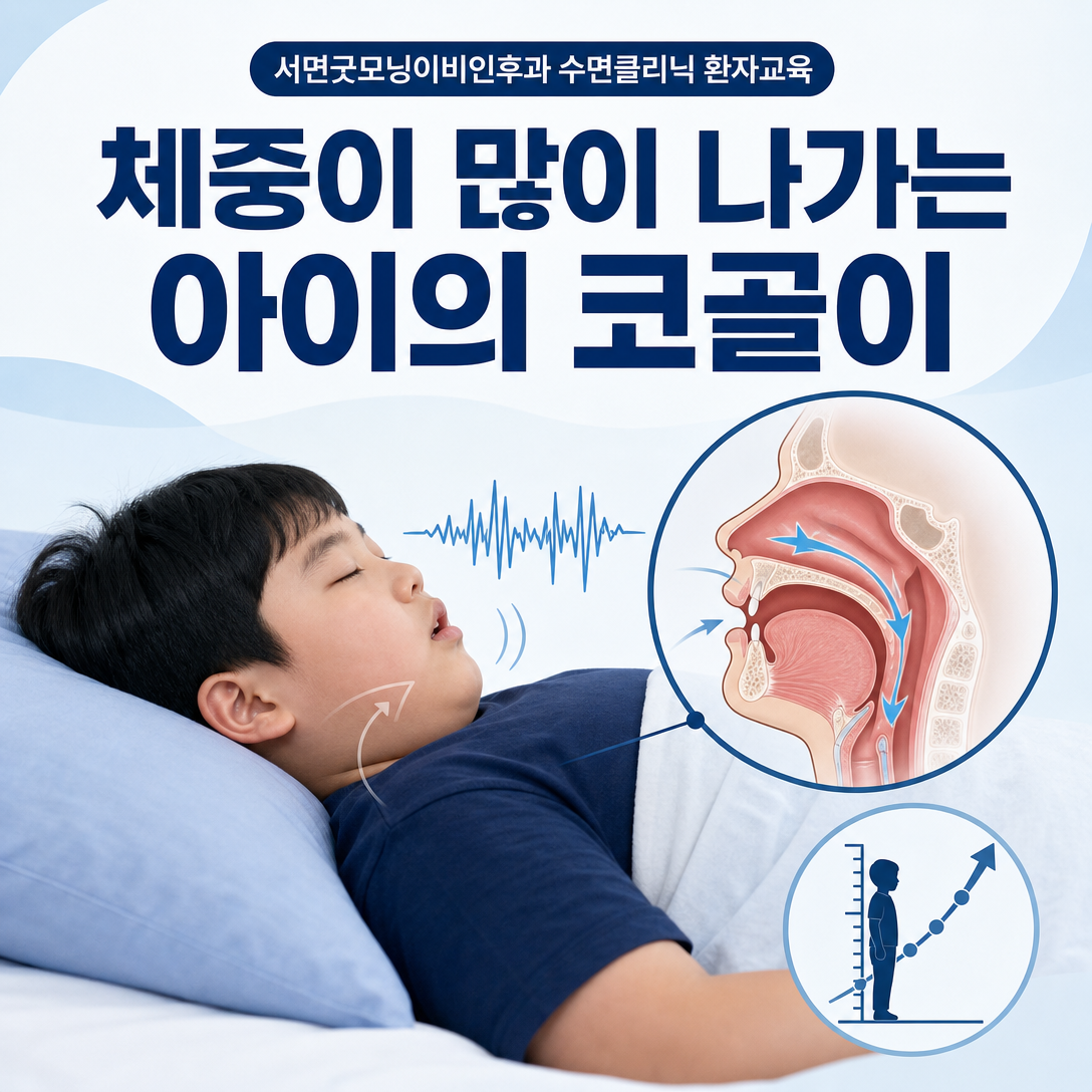 체중이 많이 나가는 아이의 코골이를 성장곡선과 상기도 상태를 함께 평가하는 교육 이미지