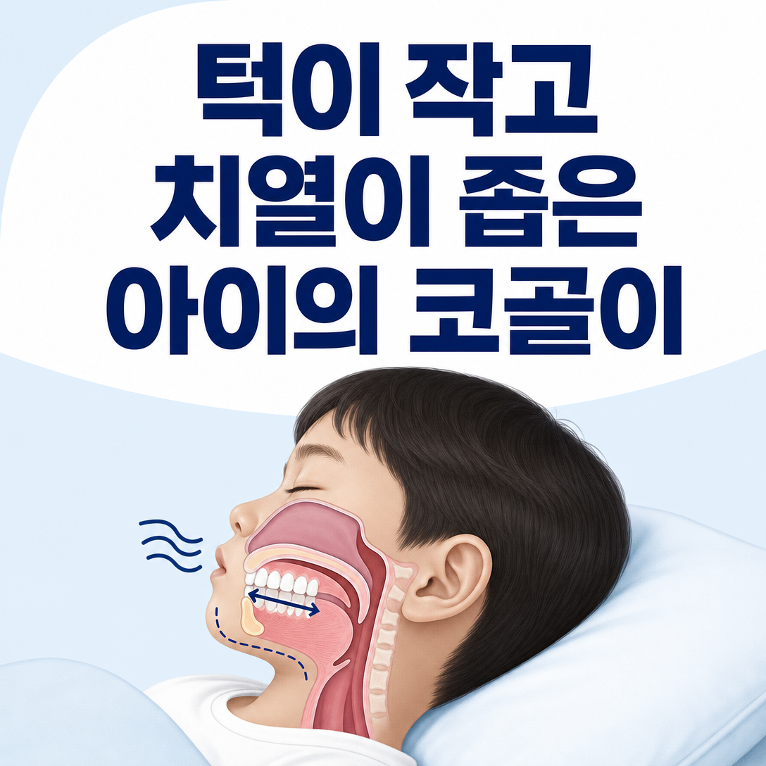 턱이 작고 치열이 좁은 아이의 코골이와 상기도 관계를 보여주는 대표 교육 이미지