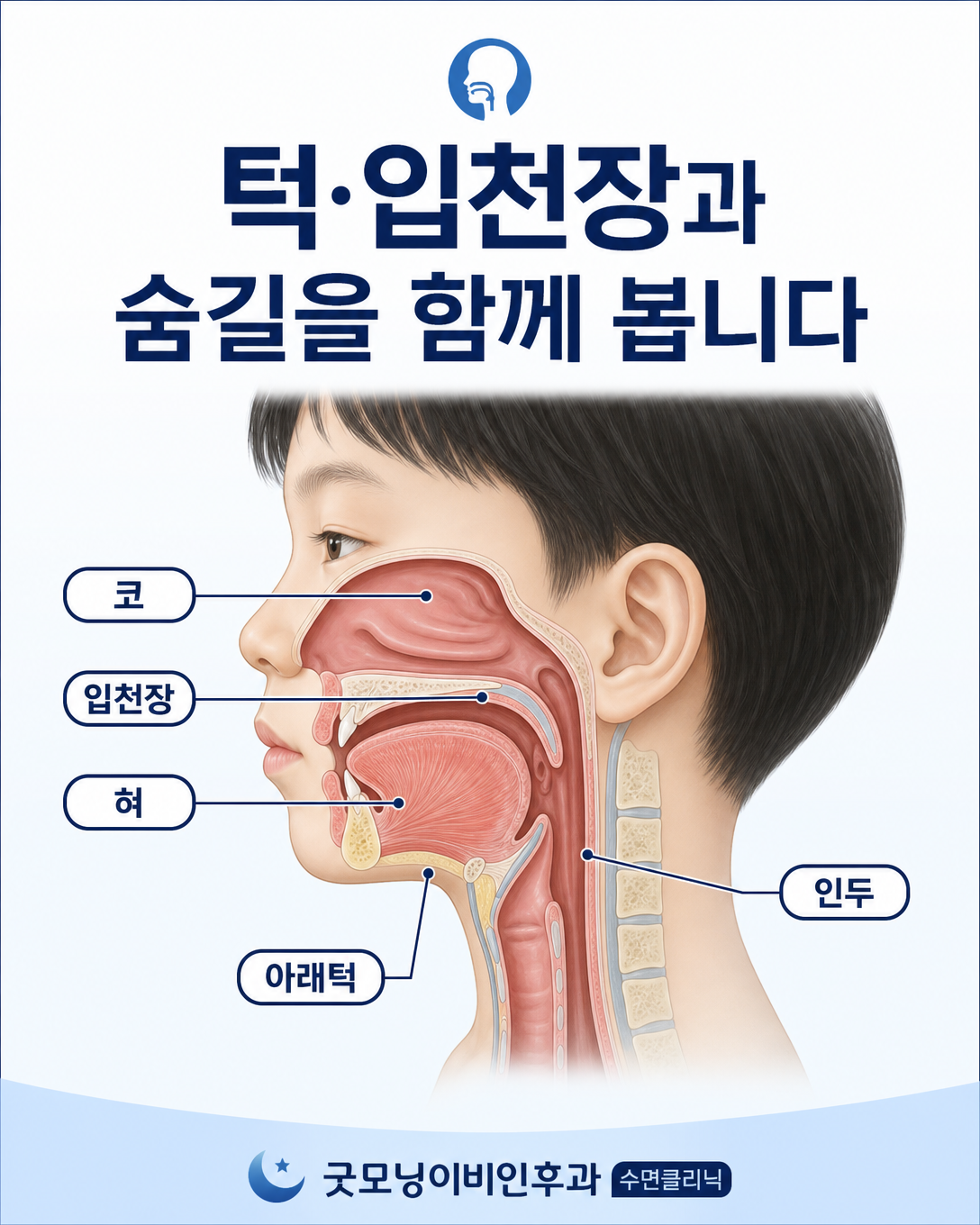 아이의 코와 입천장, 혀, 아래턱 및 목의 상기도 위치 관계를 보여주는 해부학 도식