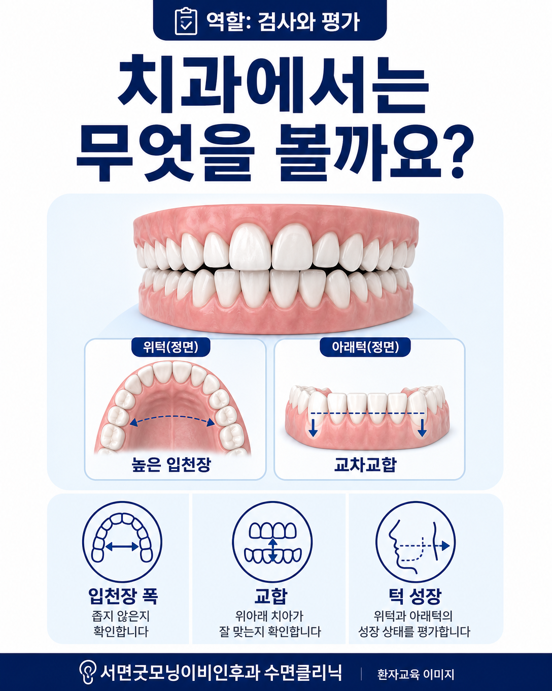 소아치과와 교정과에서 확인하는 입천장 폭, 교합과 턱 성장 평가 도식
