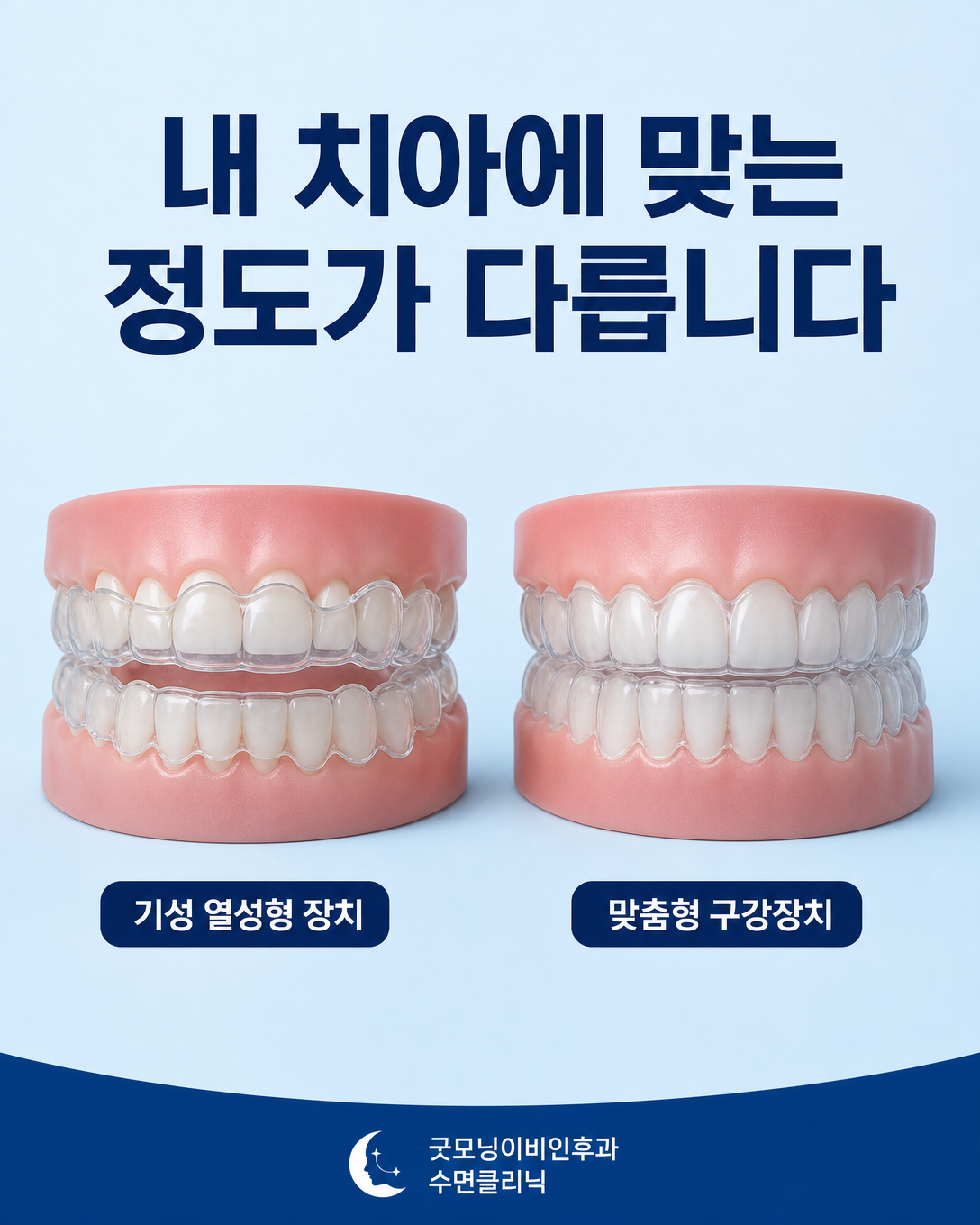 치아에 헐겁게 맞는 기성 장치와 개인 치아에 맞춘 구강장치 비교