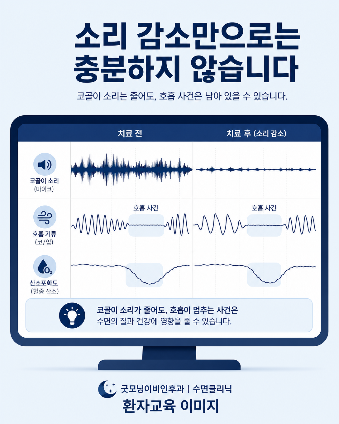 코골이 소리와 수면 중 호흡 및 산소 변화를 함께 해석하는 검사 화면