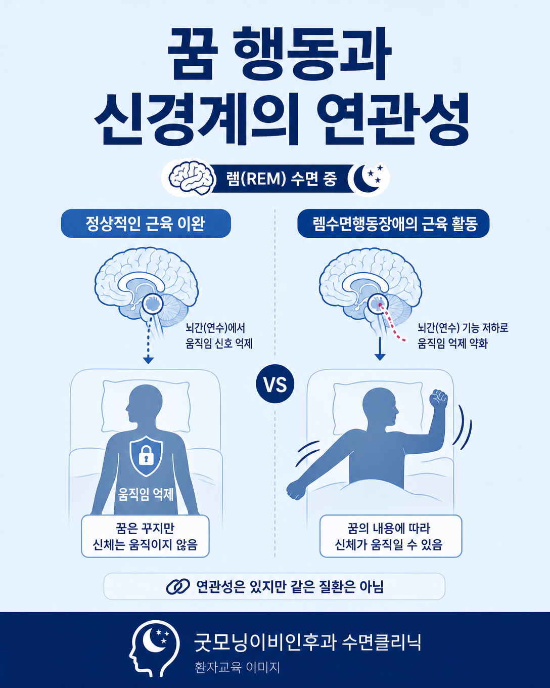 정상 렘수면의 근육 이완과 렘수면행동장애의 근육 활동을 비교한 그림