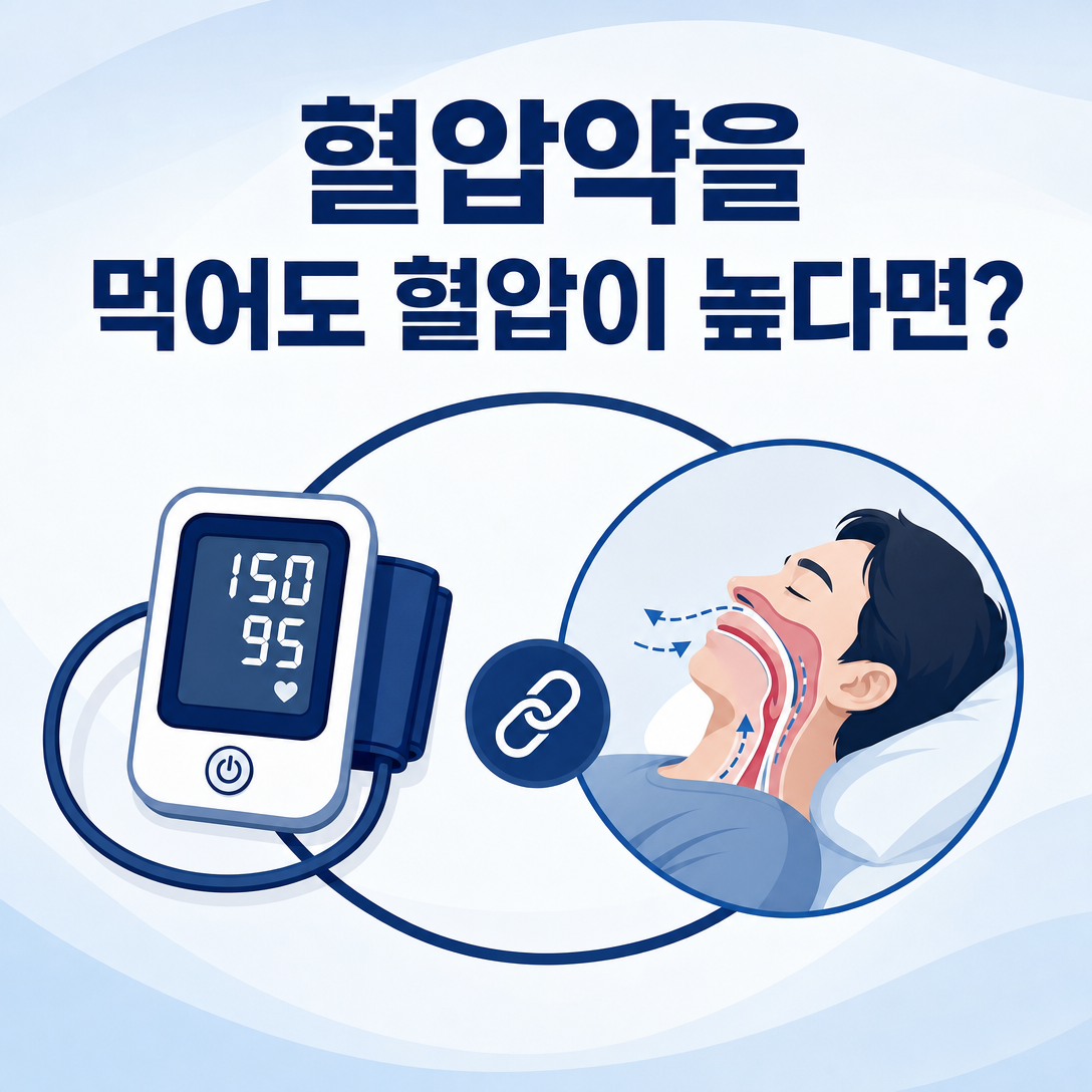 혈압약을 여러 개 복용해도 혈압이 높을 때 수면무호흡 평가를 함께 고려하는 환자교육 이미지