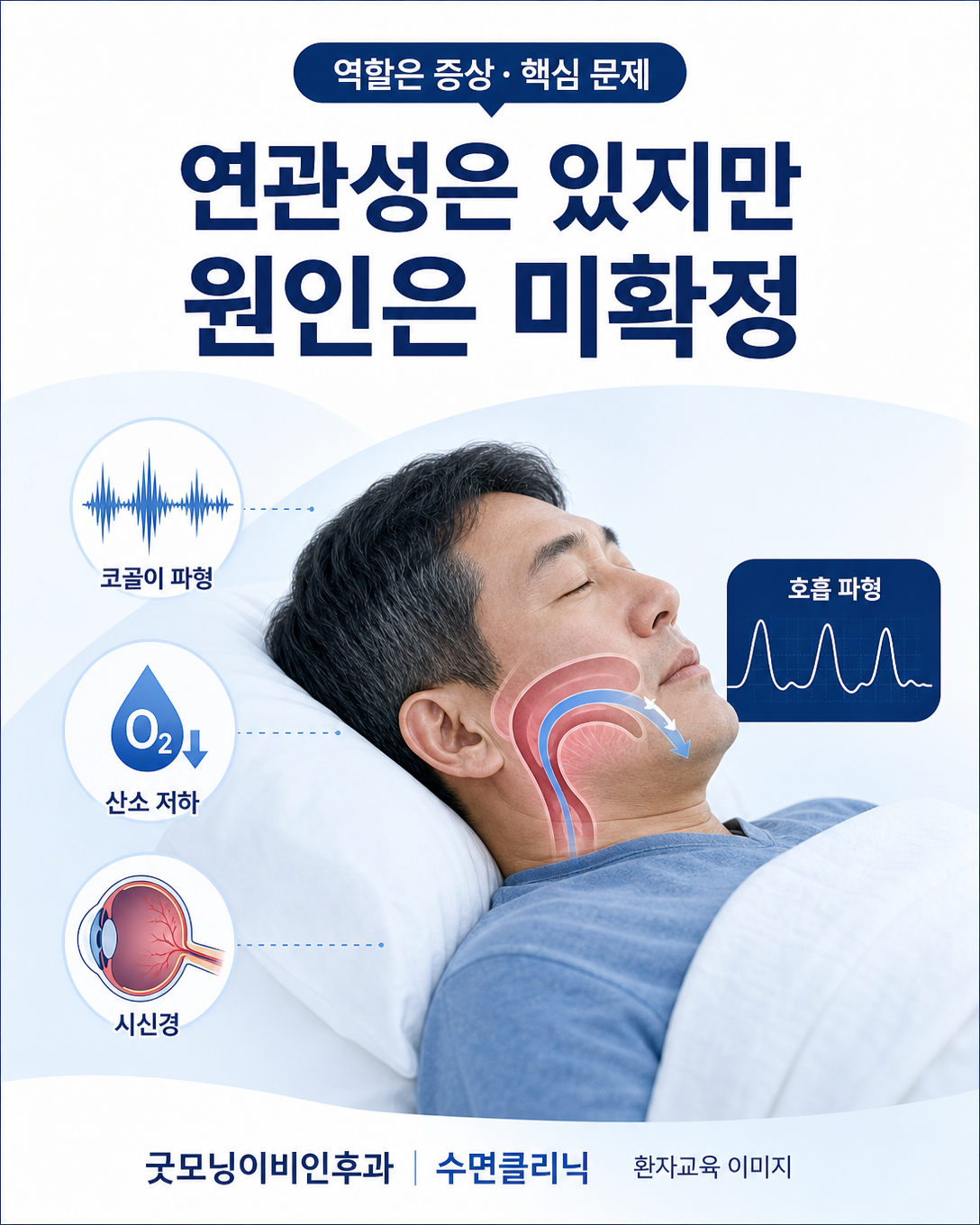 수면무호흡증과 녹내장의 연관성은 관찰됐지만 원인은 확정되지 않았음을 보여주는 이미지