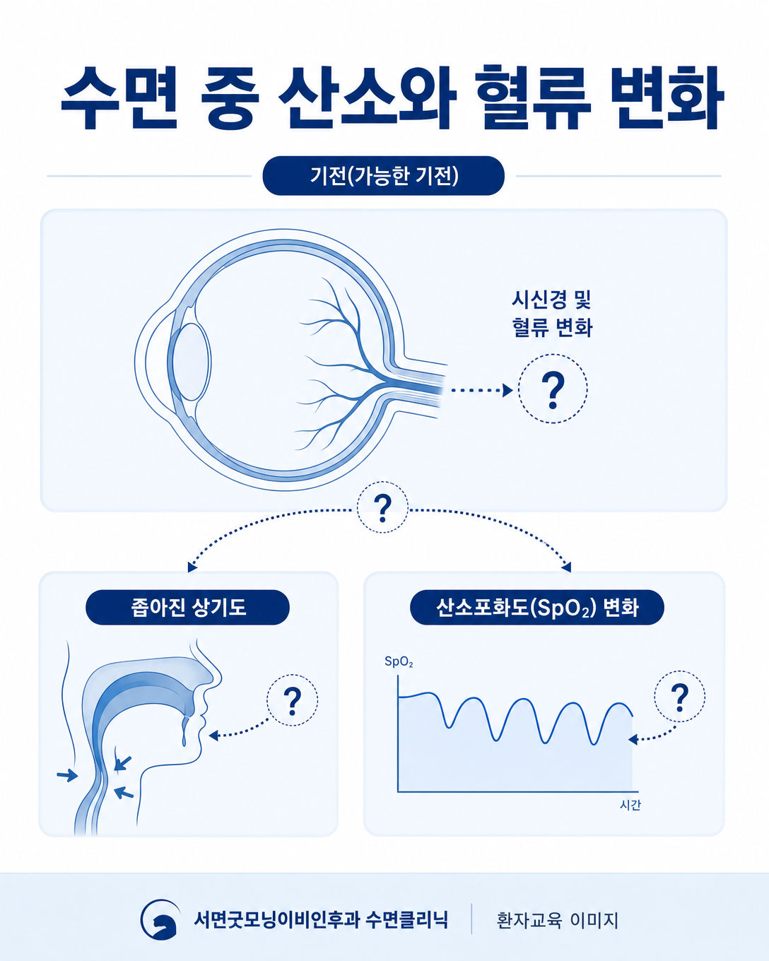 수면 중 반복되는 산소 저하와 혈류 변화가 시신경에 영향을 줄 가능성을 설명하는 도식
