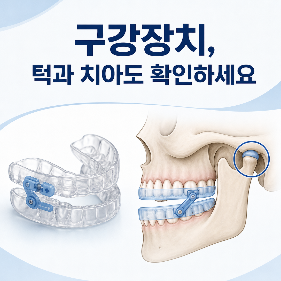 수면무호흡증 구강장치 장기 사용에 따른 턱관절과 치아 변화를 설명하는 대표 이미지