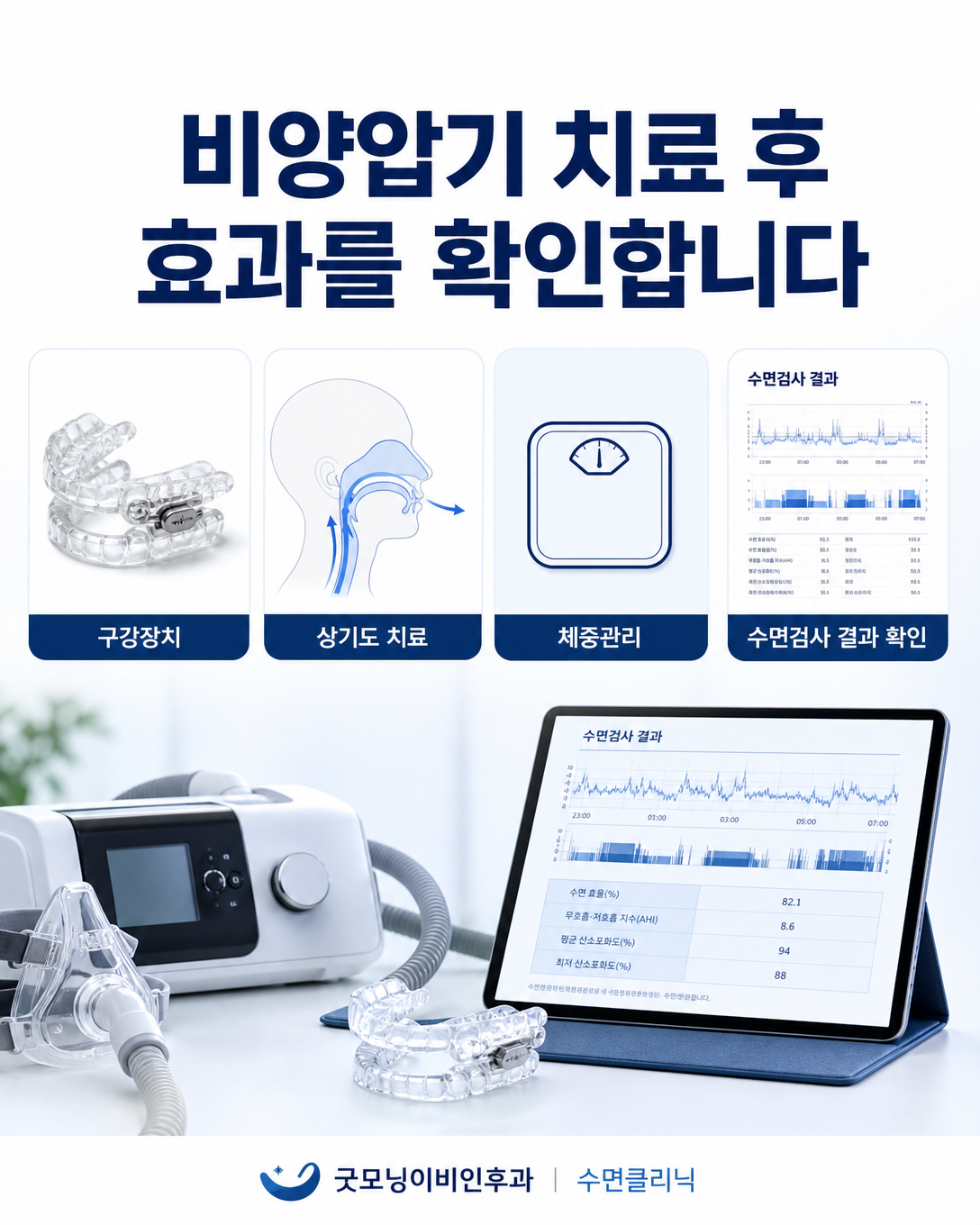 구강장치, 상기도 치료, 체중관리 등 비양압기 치료 후 효과를 추적검사로 평가하는 이미지
