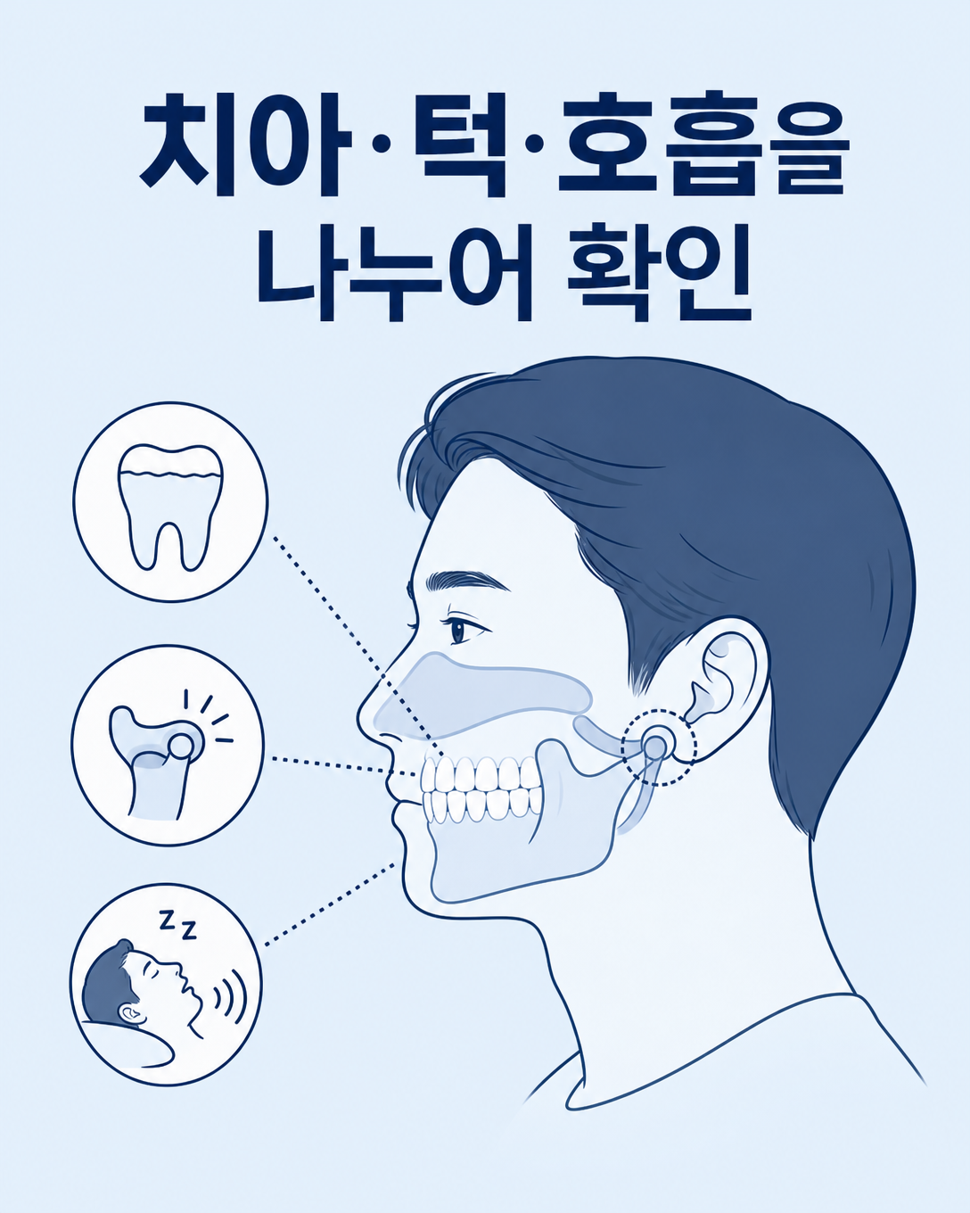 치아 마모와 턱 통증, 코골이 증상을 나누어 확인하는 교육 도식