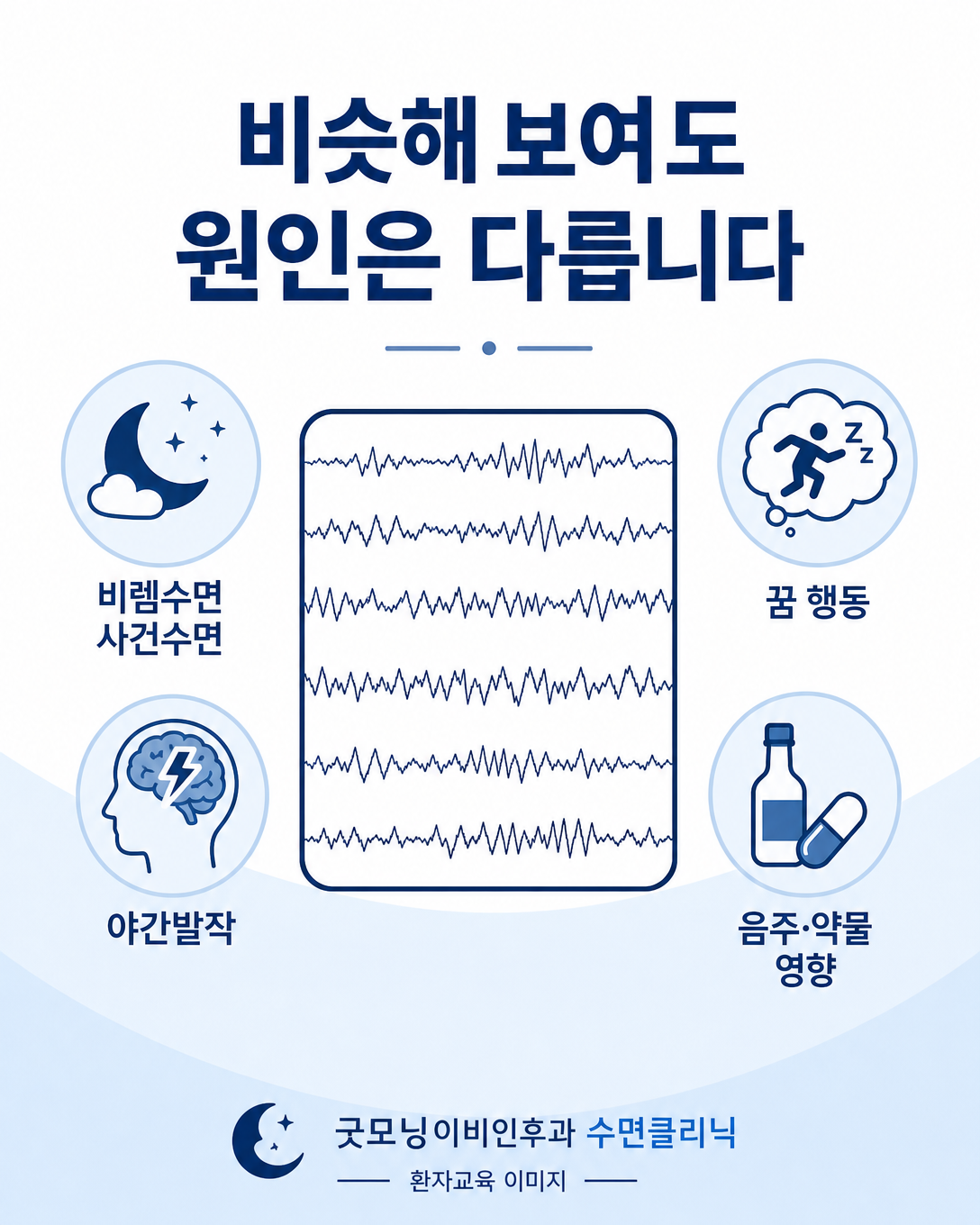 비렘수면 사건수면과 렘수면행동장애, 야간발작, 약물 영향을 감별하는 이미지