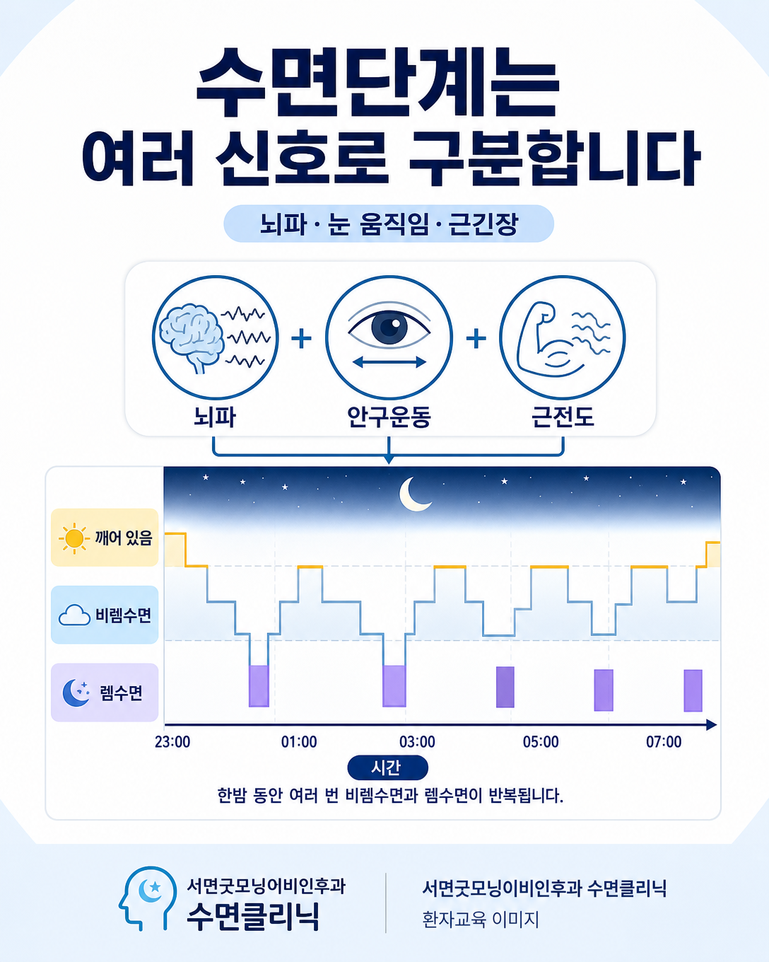 뇌파와 안구운동 및 근전도로 수면단계를 구분하는 수면구조 도식