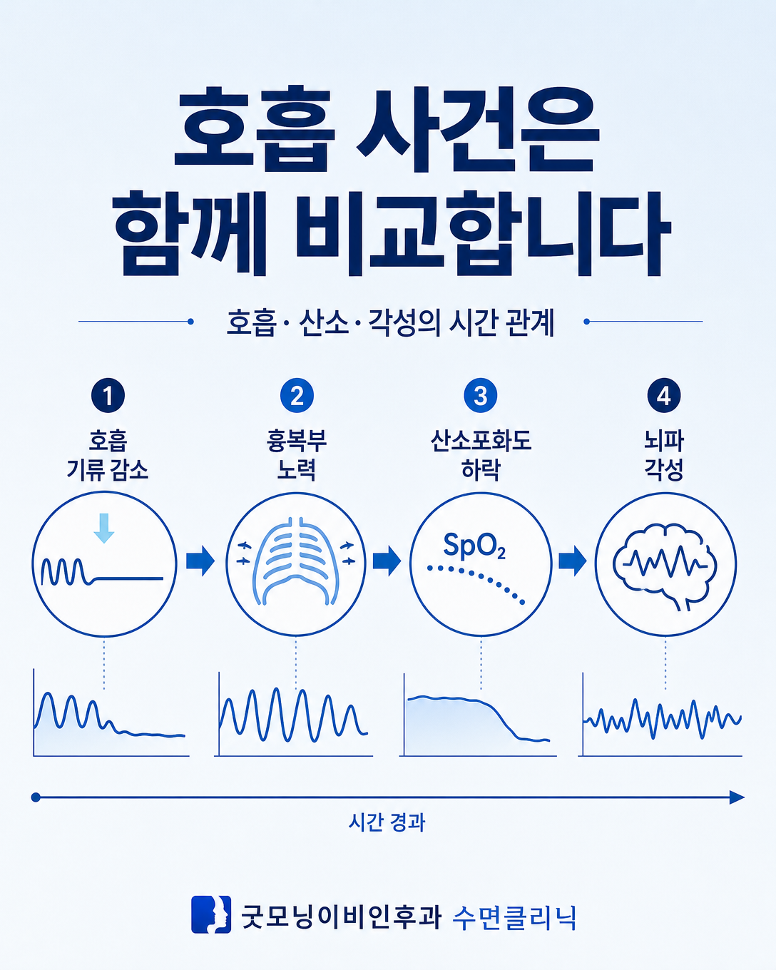 호흡 기류와 흉복부 노력, 산소포화도, 각성 반응을 함께 비교하는 도식