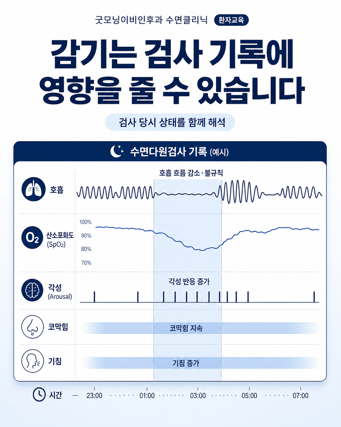 급성 코막힘과 기침이 수면다원검사의 호흡 및 각성 기록에 영향을 줄 수 있음을 나타낸 도식