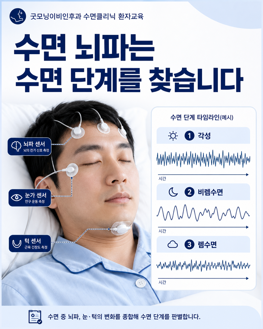 수면다원검사 뇌파와 안구운동·턱 근전도로 수면 단계를 구분하는 모습
