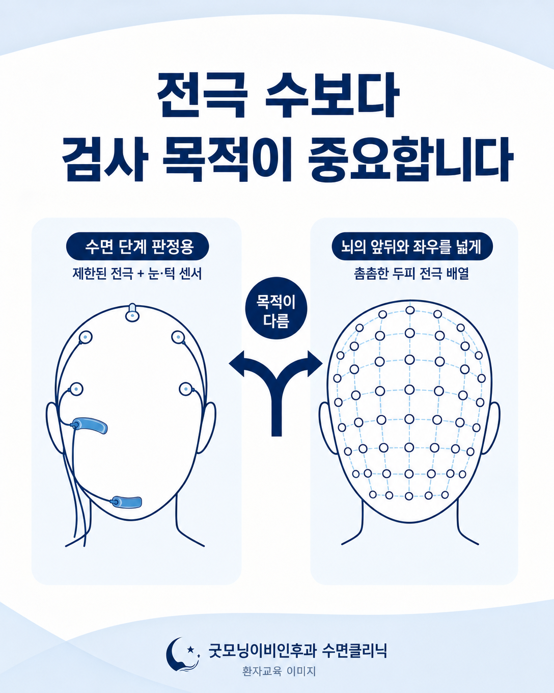 수면다원검사 뇌파와 일반 뇌파검사의 전극 구성을 비교한 그림