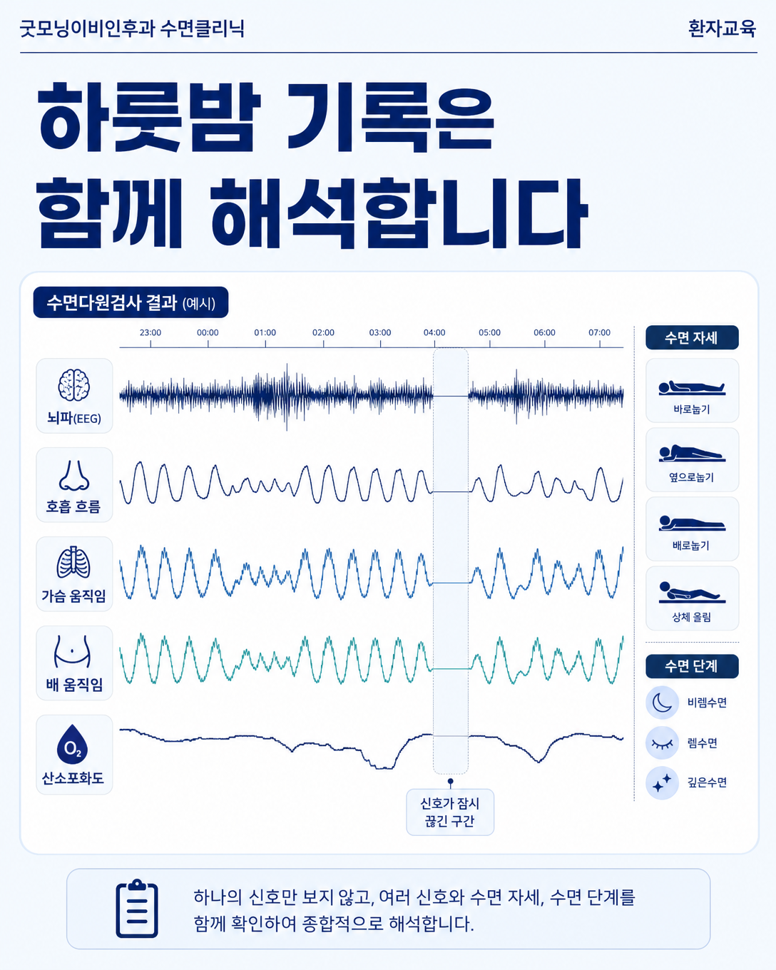 뇌파와 호흡, 산소포화도 등 수면다원검사 신호를 같은 시간축에서 해석하는 화면