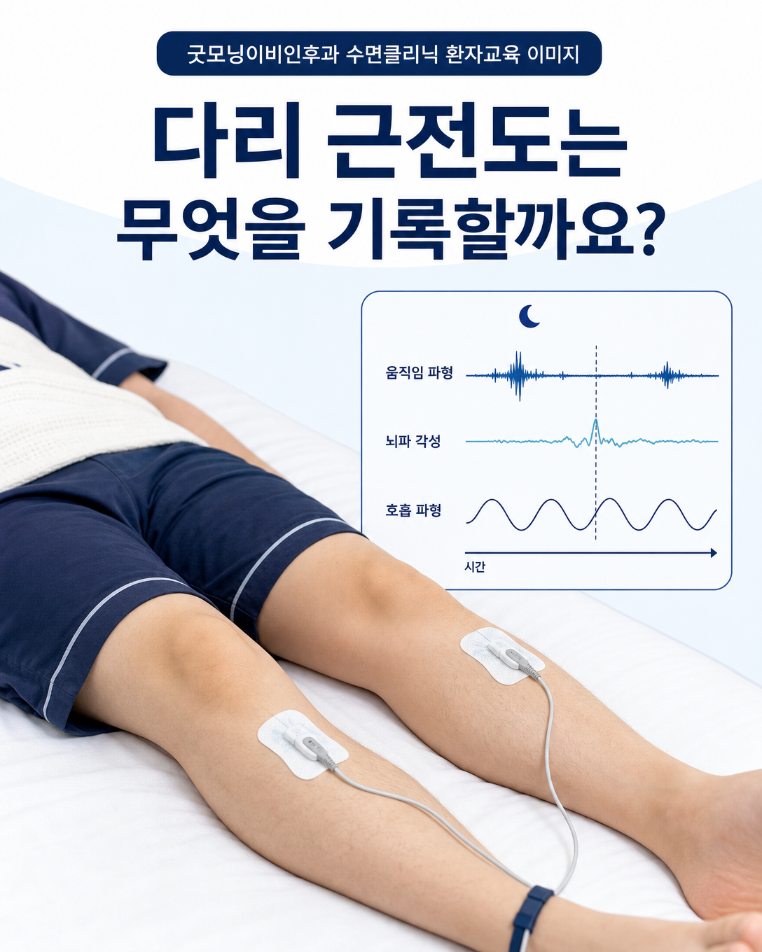 수면다원검사에서 다리 근전도와 뇌파·호흡 신호를 함께 기록하는 방법
