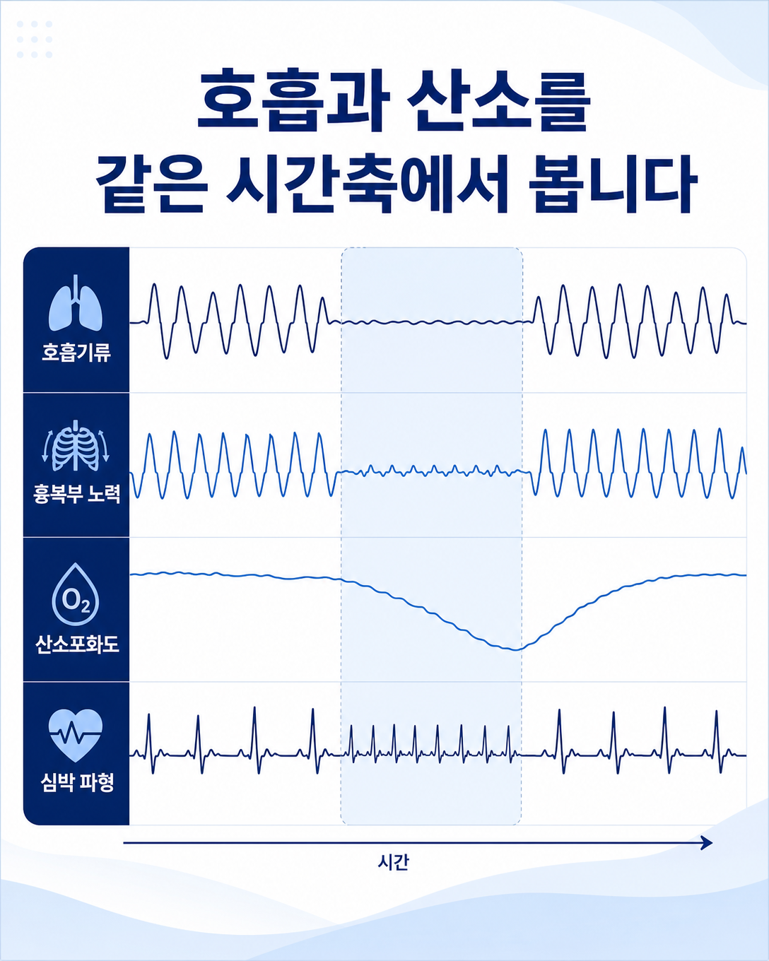 호흡기류와 흉복부 노력, 산소포화도, 심박 기록을 같은 시간축에서 비교한 도식