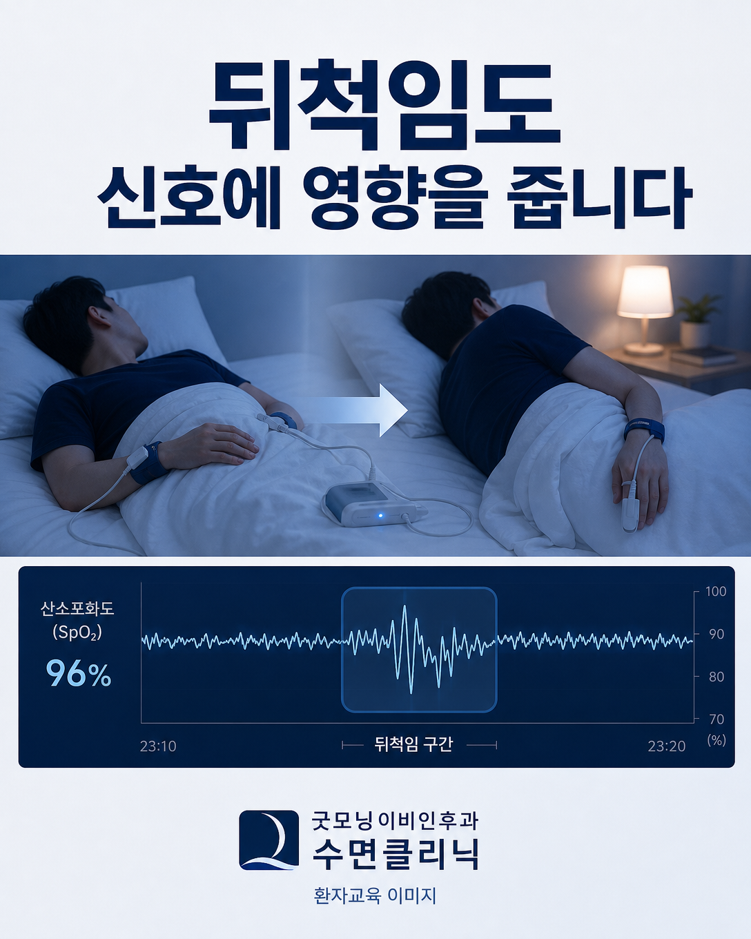 수면 중 자세 변화와 움직임이 산소포화도 센서 신호에 미치는 영향을 보여주는 이미지