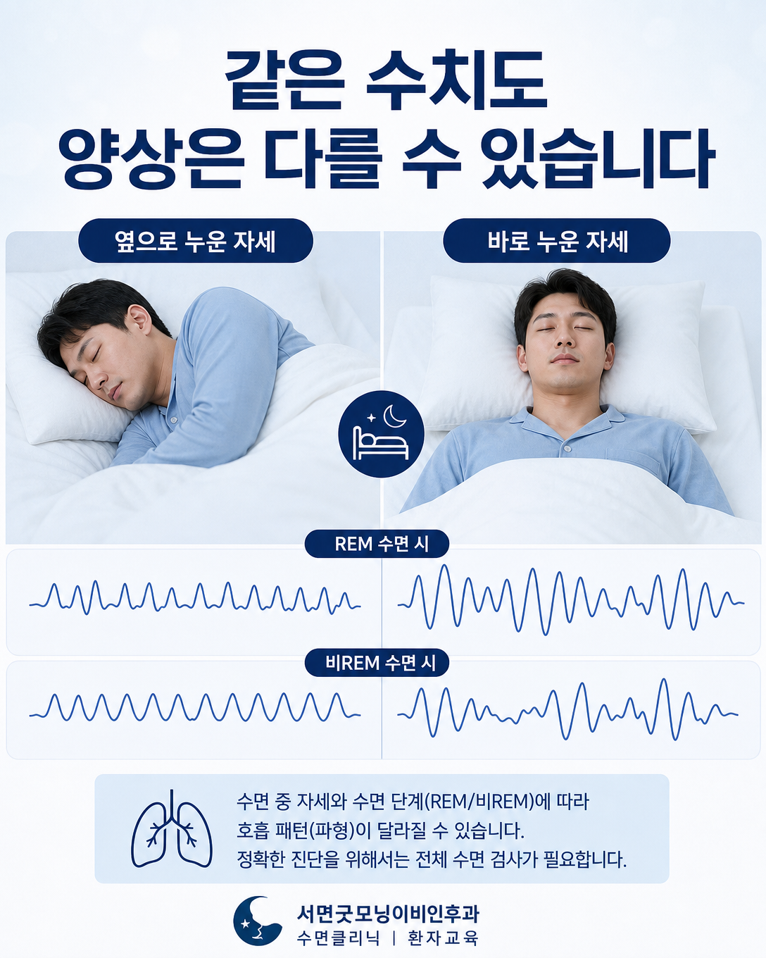 수면 단계와 자세에 따라 호흡 사건의 양상이 달라질 수 있음을 보여주는 이미지