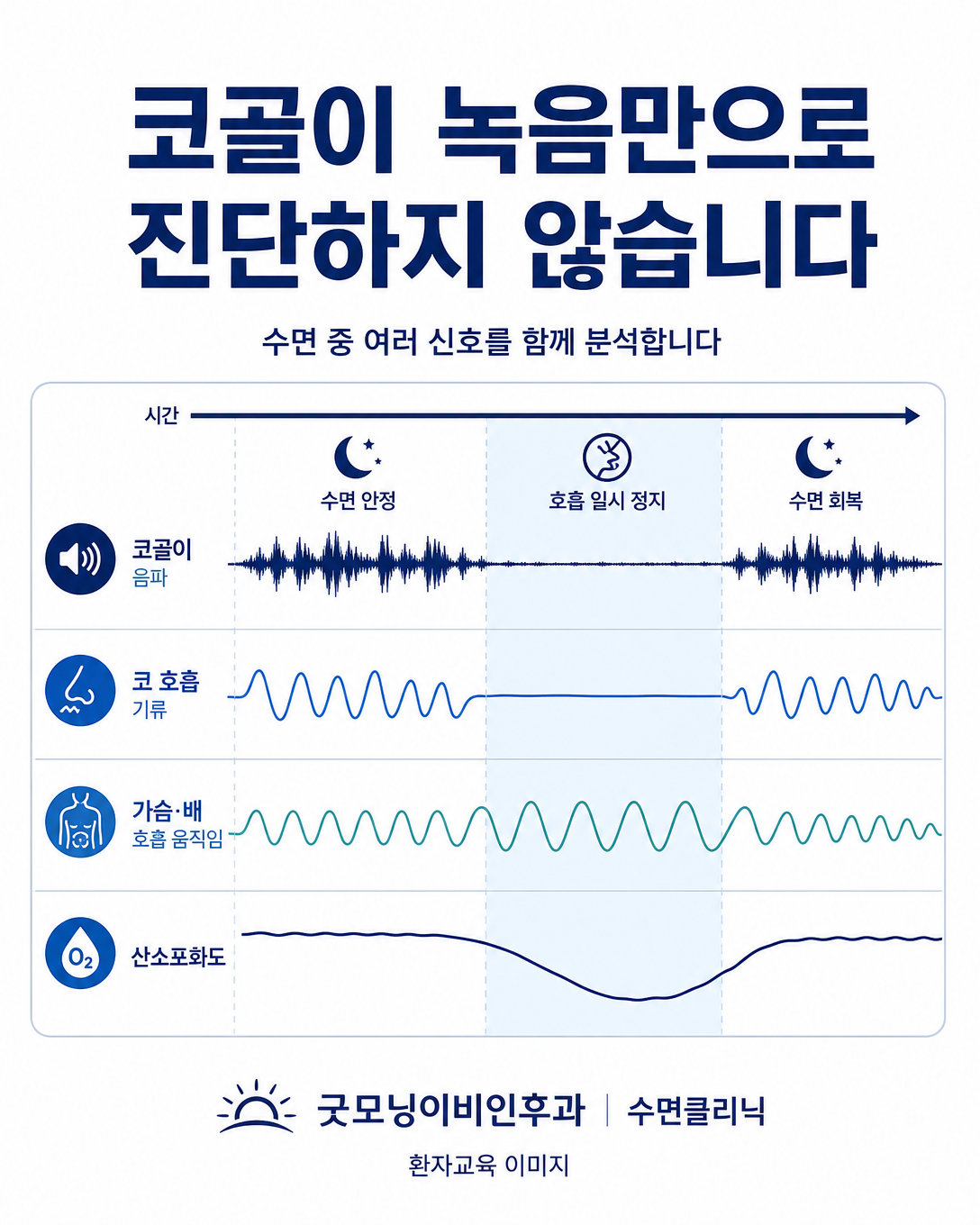 코골이 소리를 호흡 기류와 호흡 노력, 산소포화도 기록과 함께 비교하는 시간축 도식
