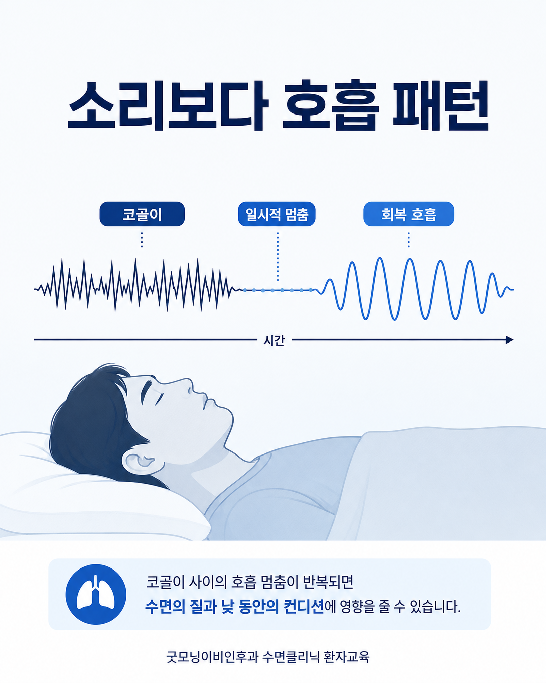 코골이 사이의 침묵과 회복 호흡 등 호흡 패턴을 보여주는 교육 이미지