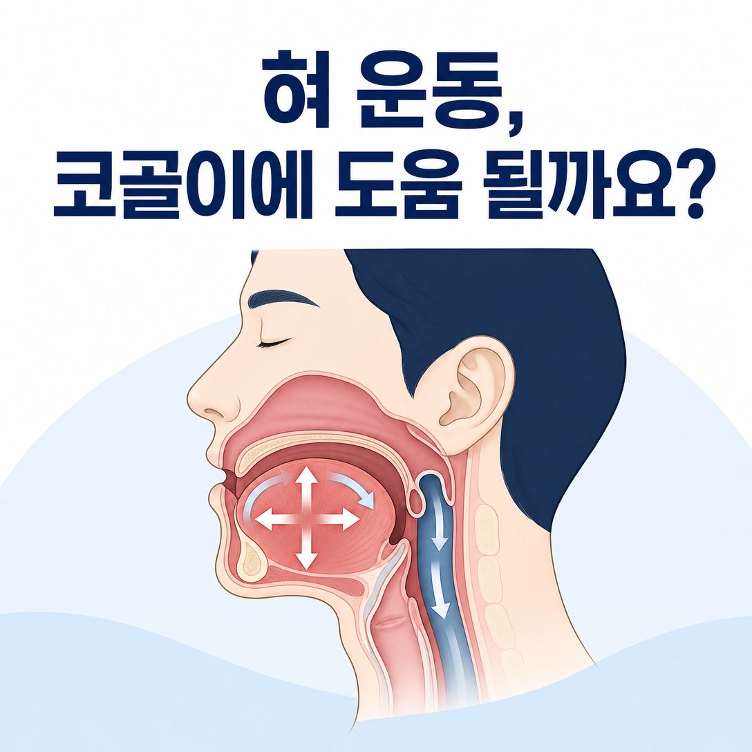 혀와 입 주변 근육 운동이 코골이와 수면무호흡증에 도움이 되는지 설명하는 대표 이미지