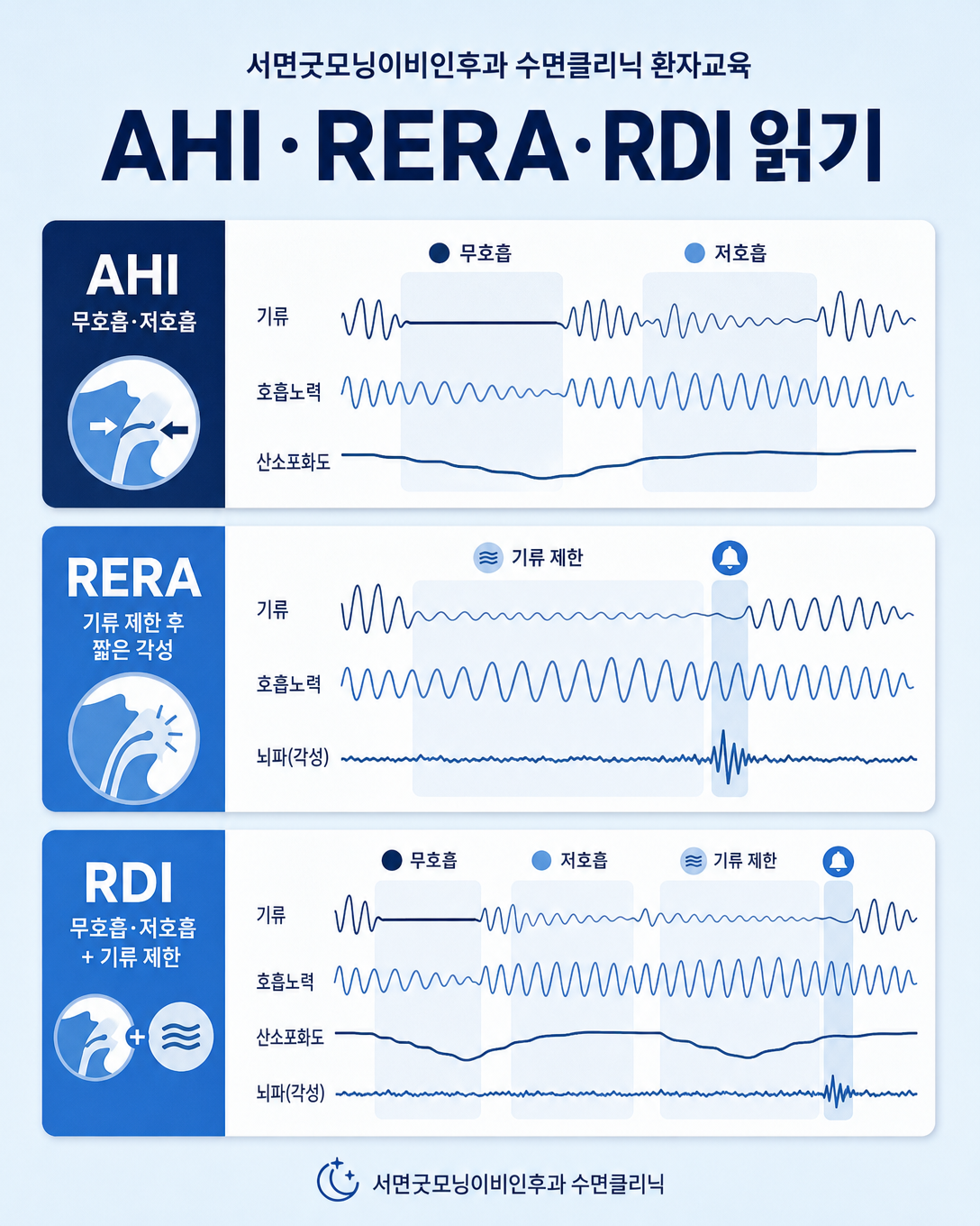 수면검사 결과의 AHI, RERA, RDI 차이를 설명하는 인포그래픽