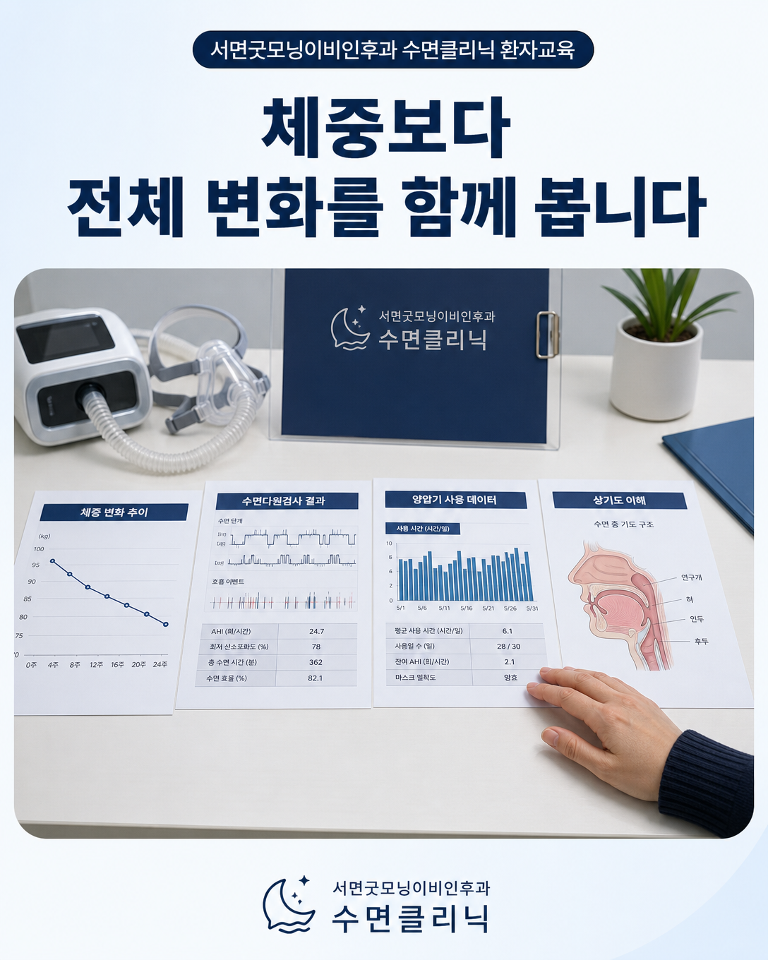 체중 변화, 수면다원검사 결과와 양압기 사용 데이터를 종합해 판단하는 진료 관점 이미지